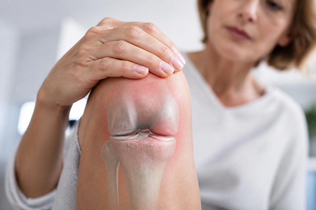 découvrez comment identifier les premiers symptômes de l'arthrose du genou et apprendre à reconnaître les signes avant l'apparition de la douleur pour mieux agir.